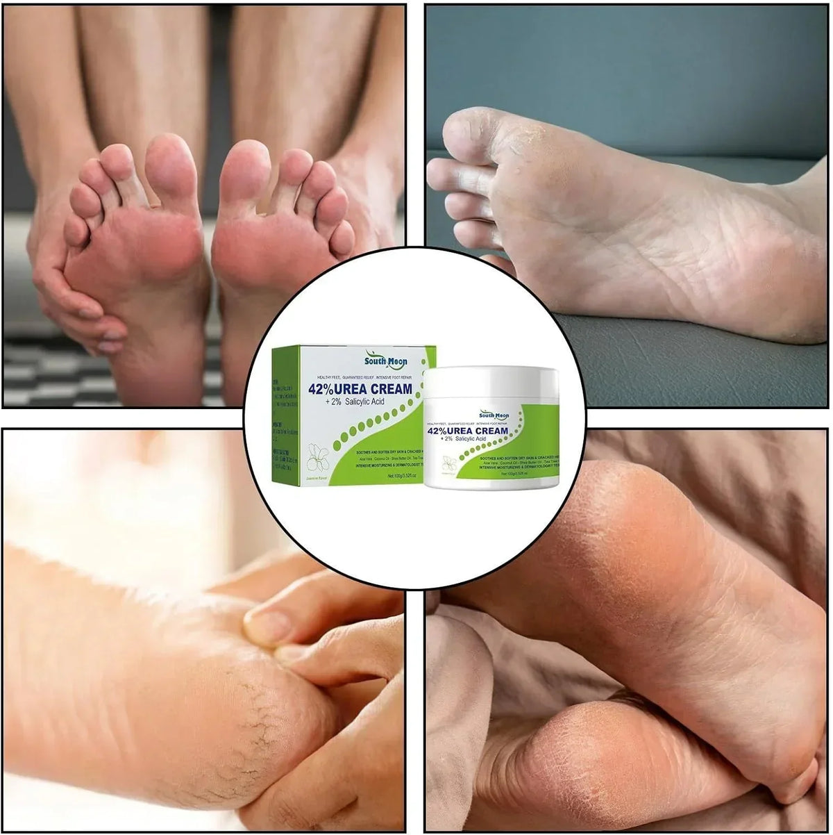 South Moon 42% Urea Cream with 2% Salicylic Acid, moisturizing and exfoliating skincare product in a white jar.